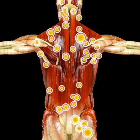 Neuromuscular Massage Therapy
